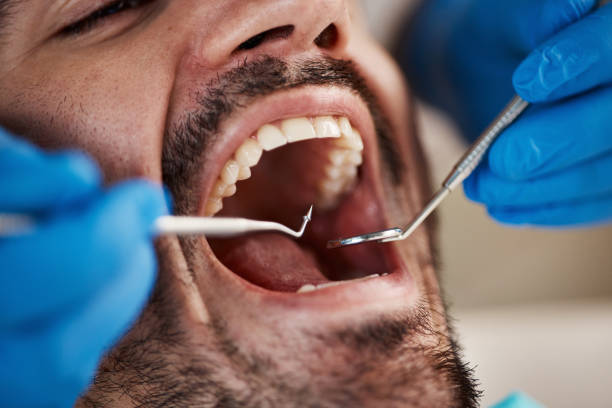 Fast & Reliable Emergency Dental Services in NE