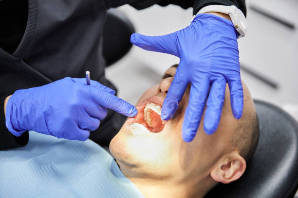 Best Emergency Dental Care for Broken or Chipped Teeth in Gibbon, NE